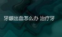 牙龈出血怎么办 治疗牙龈出血的5款食疗